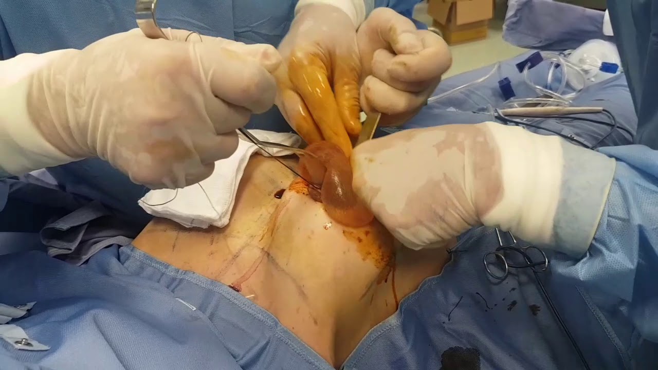 Armando Marcelletti-2