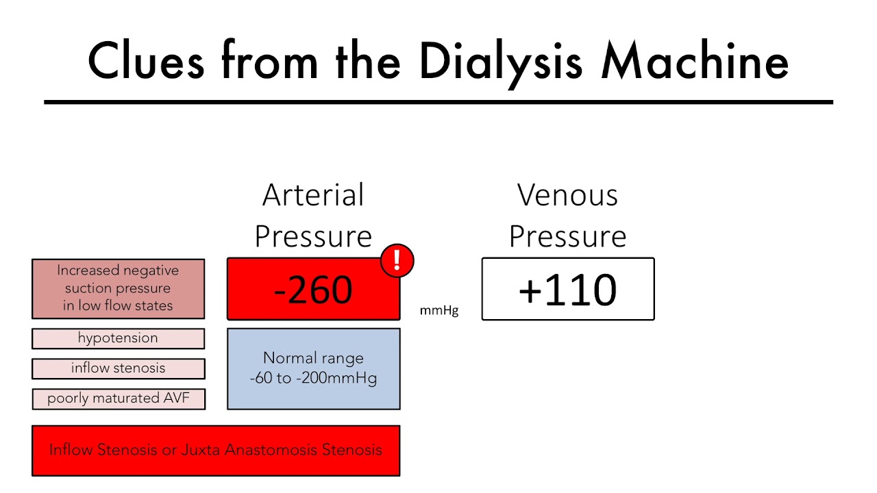 Hemodialysis Access 101 04 Part 2 - Clues from the Dialysis Machine