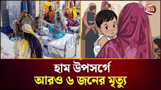 হামের উপসর্গে প্রাণহানি বাড়ছেই । Measles Outbreak | Channel 24