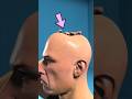 If You Have a Dent on Your Head from Headphones, WATCH THIS! (Explained!)