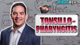 Tonsillopharyngitis | Clinical Medicine