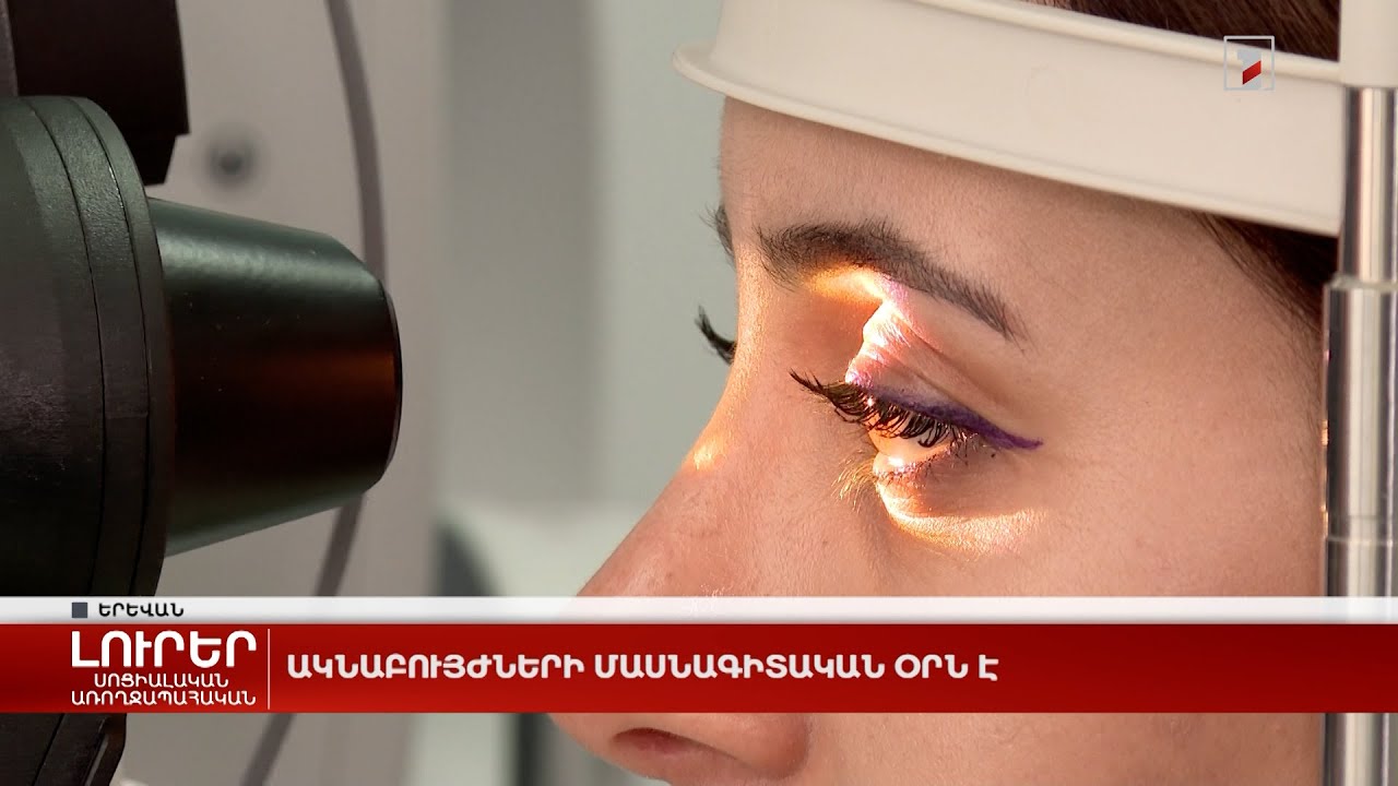 Ակնաբույժների մասնագիտական օրն է