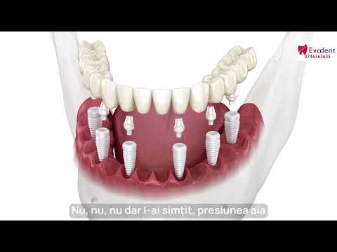 Pe D. Gheorghe nu l-a durut. Ne recomandă. Vezi de ce?