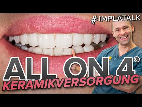 All on 4 - Final ceramic restoration live after healing phase