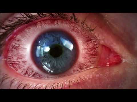 Siwy - Proces (Prod. Isekai)