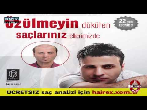 download lagu mp3 mp4 Diyarbakr Sa Ekim Merkezleri, download lagu Diyarbakr Sa Ekim Merkezleri gratis, unduh video klip Diyarbakr Sa Ekim Merkezleri