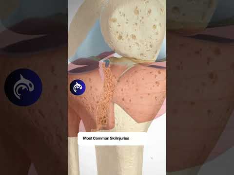 Guess The Spine Injury And Procedure Challenge