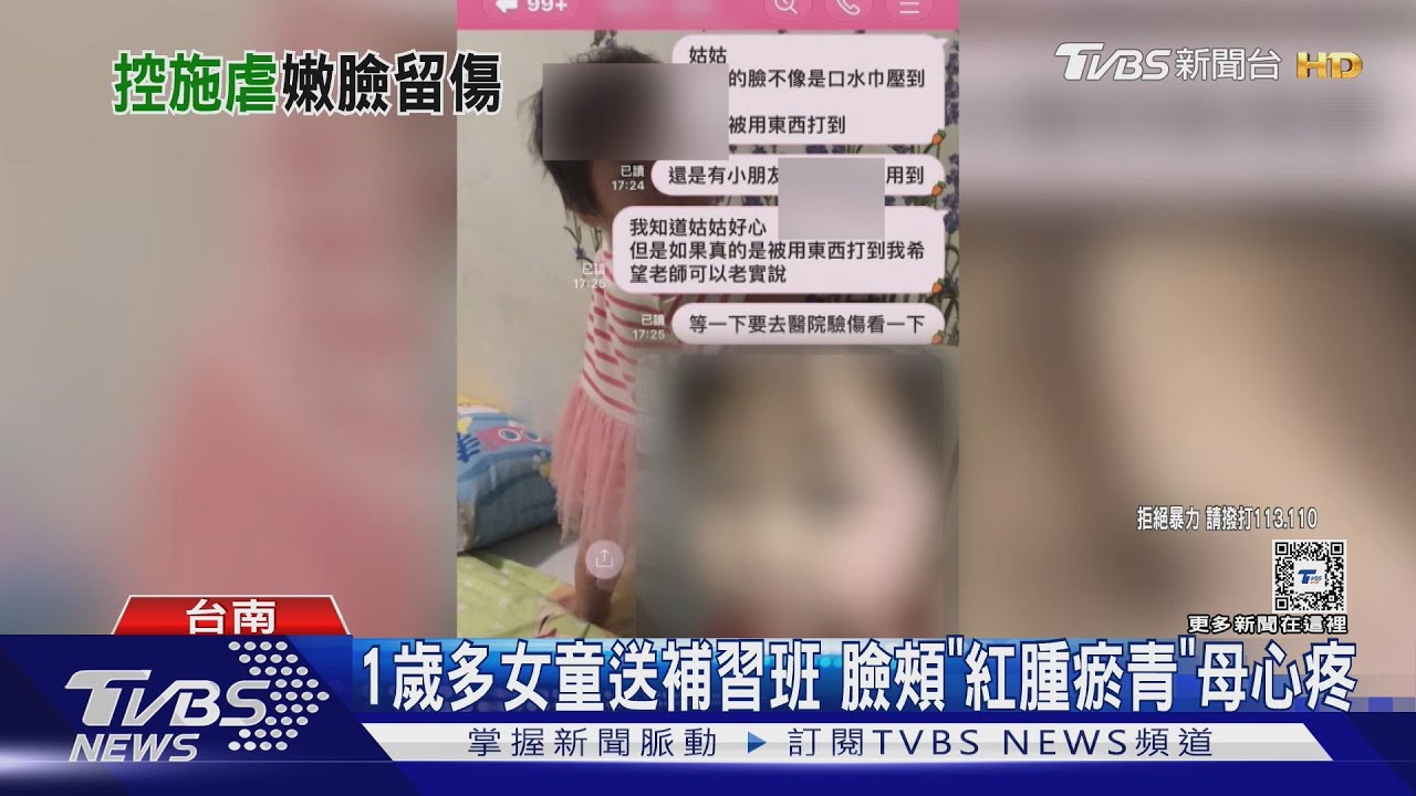 1歲多女童送補習班 臉頰「紅腫瘀青」母心疼
