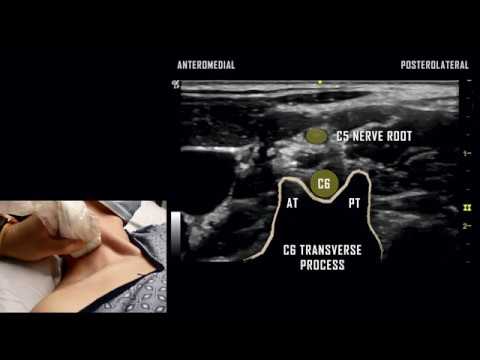 Basic Cervical Mapping // Ultrasound Anatomy Review