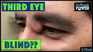 A Life-Changing Pop with Dr Pimple Popper