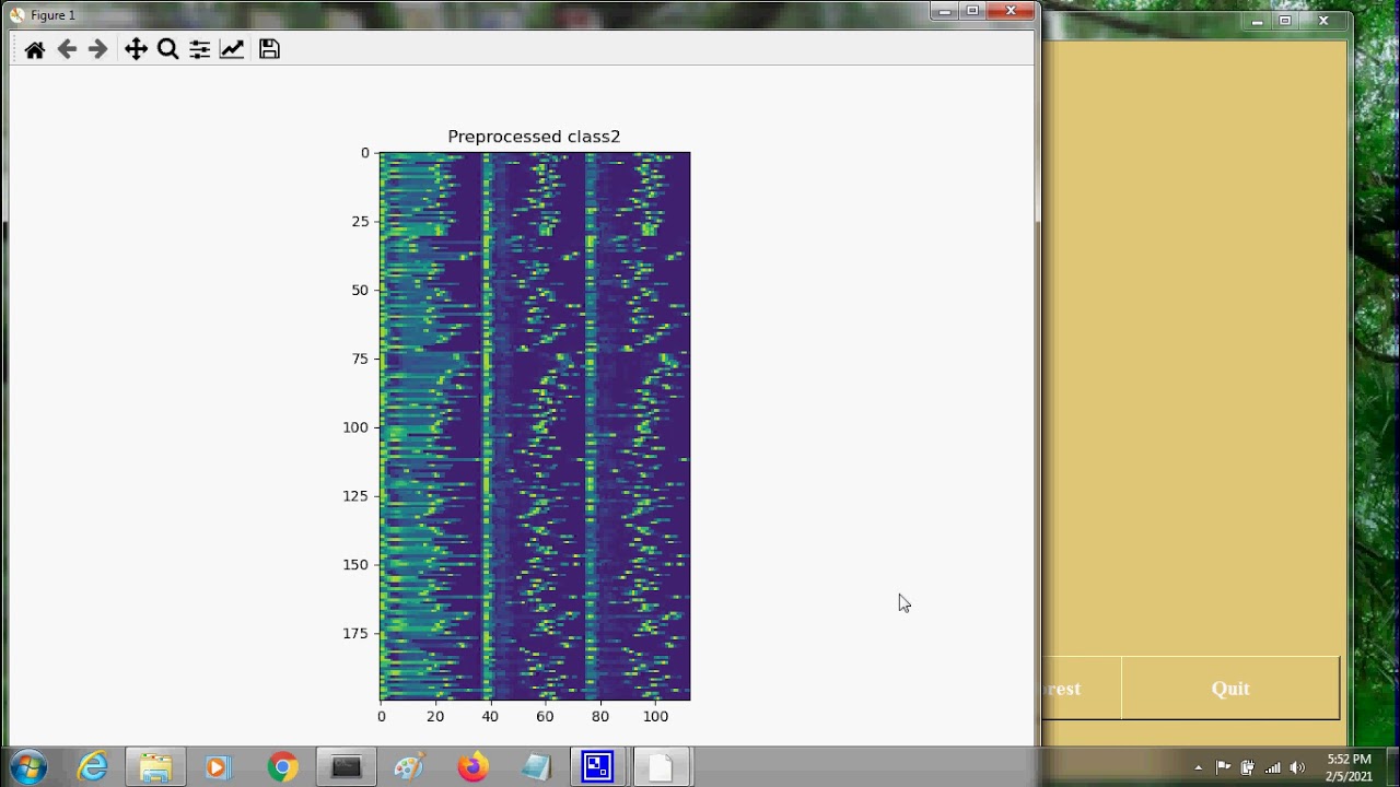 Heart Disease detection from ECG Signal Dataset using Machine learning