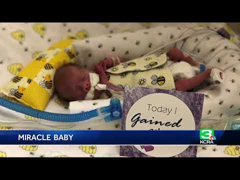 Miracle Premature Baby Goes Home On Due Date