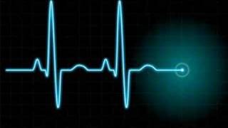 TRANCE VISIONS- The Mystery - Fever (Original Mix)