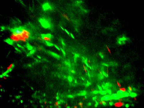 Makeshift Laser Lightshow Effects, with Red-Green Party Laser!