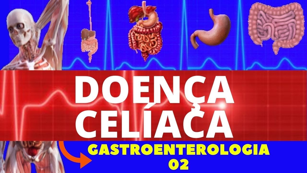 DOENÇA CELÍACA (CAUSAS, SINTOMAS, DIAGNÓSTICO E TRATAMENTO) - GASTROENTEROLOGIA