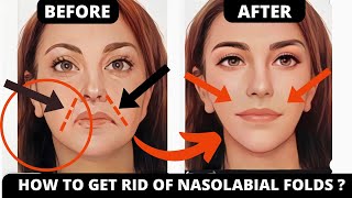 🛑FAST RESULT ! SMILE LINES FACIAL EXERCISES (NASOLABIAL FOLDS) JOWLS, SAGGY SKIN, CHEEKS | SUBTITLES