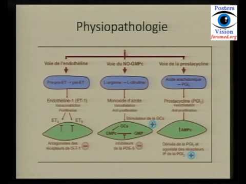 Recommandations russes pour la maladie hypertensive Enfer de mesure Korotkoff de la pression artérielle