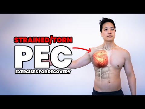 Wie man Brustmuskelzerrungen behebt – Kräftigungsübungen für den kleinen und großen Brustmuskel