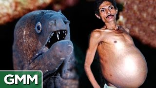 People with Shocking Things Living Inside of Them