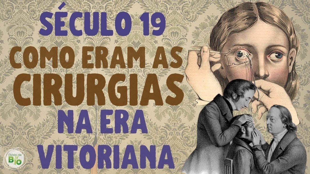 🕌 SÉCULO 19: Fatos chocantes sobre os procedimentos cirúrgicos da Era Vitoriana