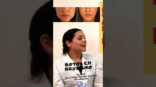 Uso de botox en bruxismo #shorts