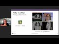 PyTorch Community Voices | TorchIO | Fernando Pérez-García