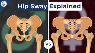 Why Do Women&#39;s Hips Sway When They Walk?