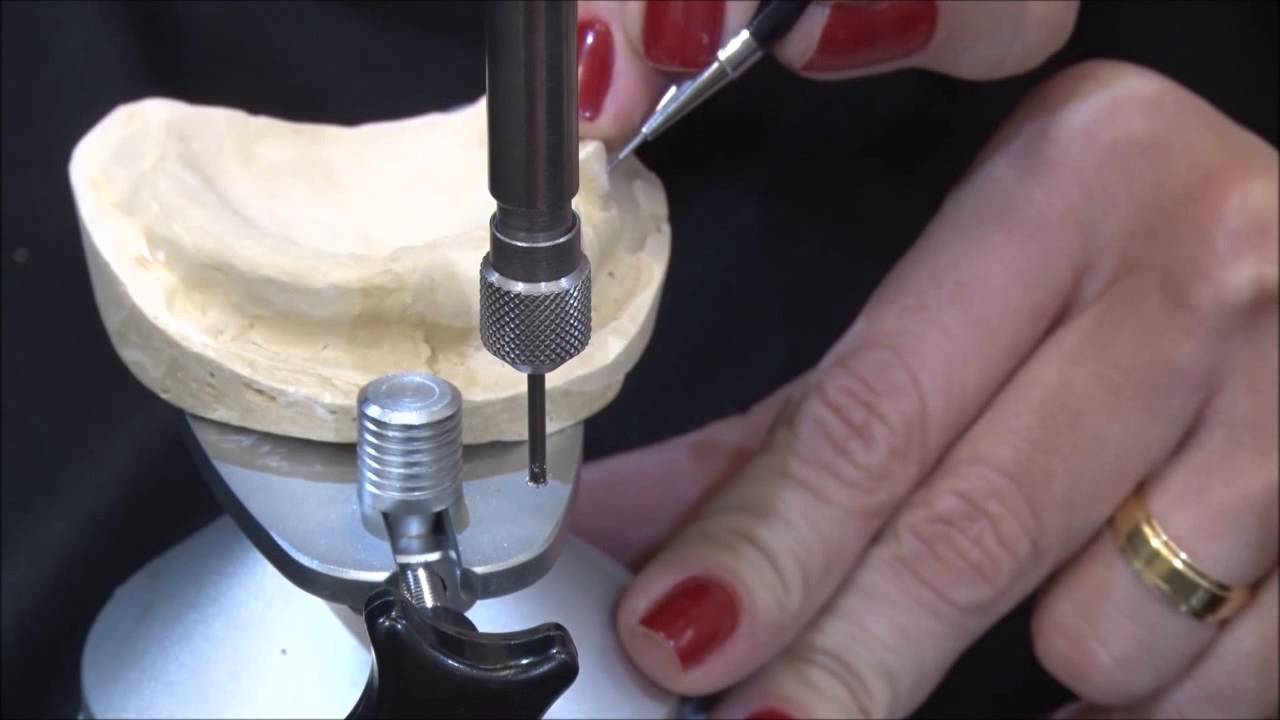 Delineamento de arcos para PPR