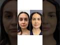 Doctor Made Her Look HOT 24 Year Old Gets Plastic Surgery