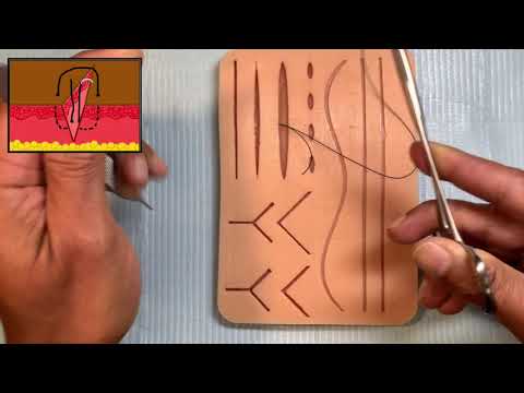 Dr. Azad's Surgery Basics: Deep Dermal Suture