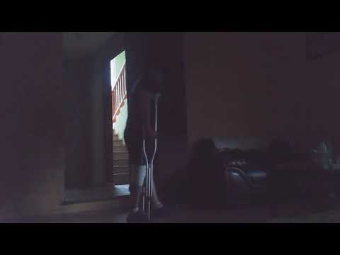 Rehabilitacion fractura tibia perone