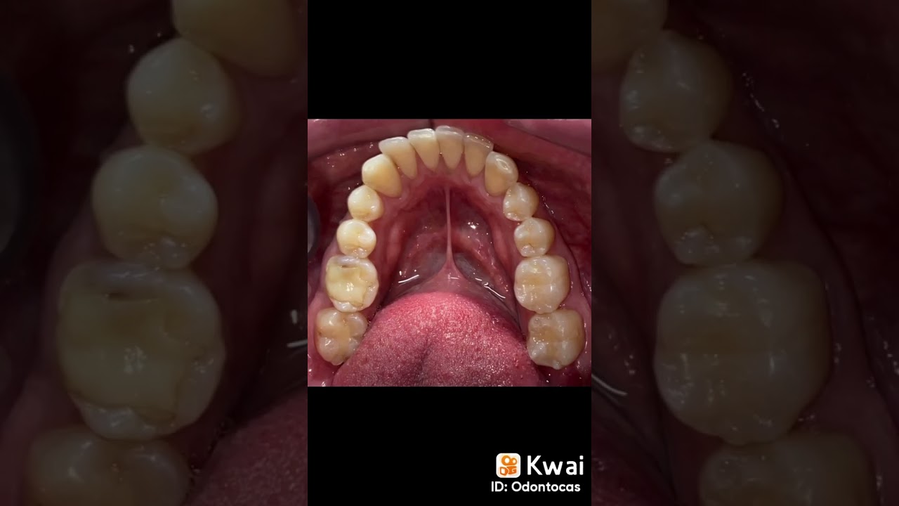 Ricardo Casados Lugo-24