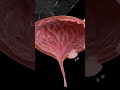 Female Cervical Cancer Shorts Medical Subscribe Trending India Pathology