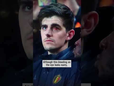 Did a bloody eye stop Thibaut Courtois?