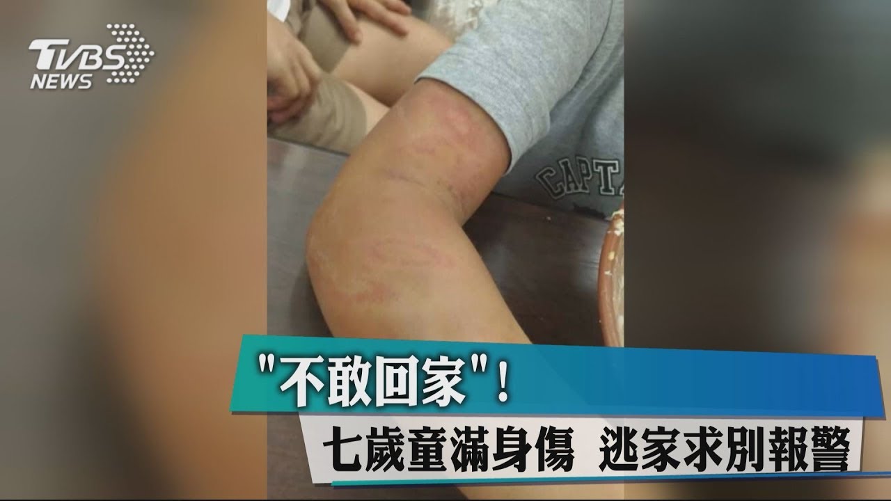 「不敢回家!」7歲童滿身傷 逃家求別報警