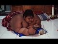 Family Puts 10 Year Old Boy Weighing 423 Pounds On Strict Diet