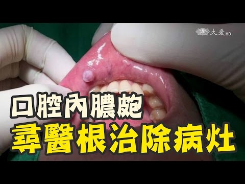 咬嘴唇內側
