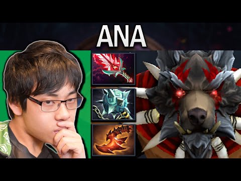 Bloodseeker Dota 2 Gameplay Ana with 26 Kills - Gleipnir