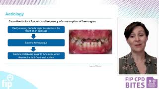 Episode 4 - Child oral health