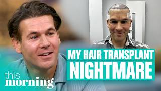 'My Botched Hair Transplant Ruined My Life' | This Morning