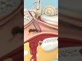 "What if a ant crawls into your ear"? 🐜🤢