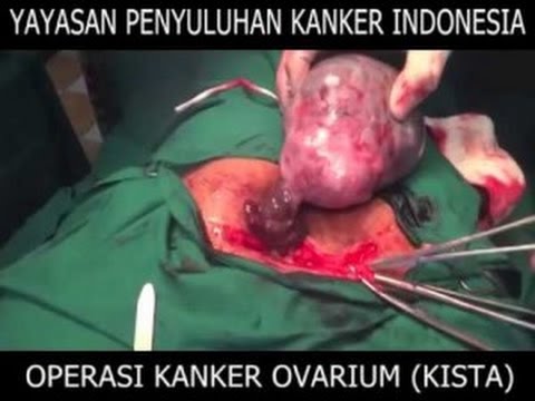 Di mana Anda dapat membeli palu Thor, dan berapa biaya Mengapa tidak ada potensi di pagi hari