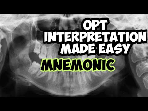 Dental Panoramic radiograph | OPT | DPT interpreting dental x-rays