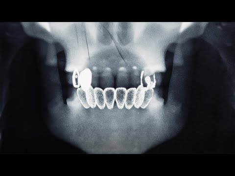 Natos y Waor and RECYCLEDJ