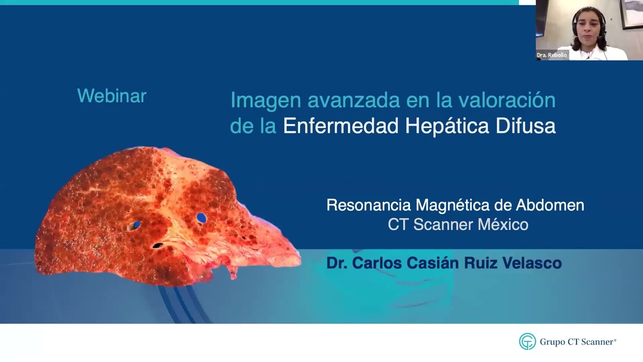 Enfermedades del hígado, hepatopatías difusas y lesiones focales