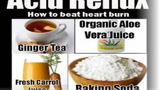 How to Cure Acid Reflux Fast Naturally - Treat Acidity (GRED) Permanently
