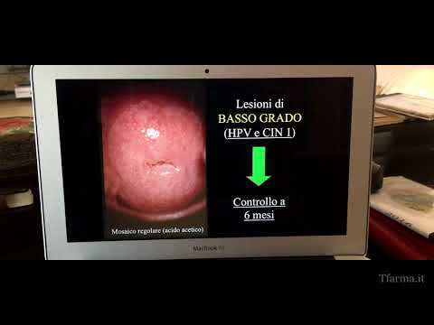 Hpv impfung contra