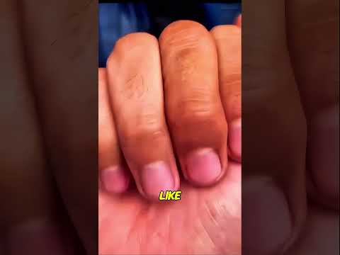 The Fish's Stunning Transformation 😯