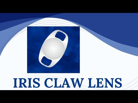 Iris Claw Lenses