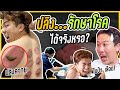 อาการ